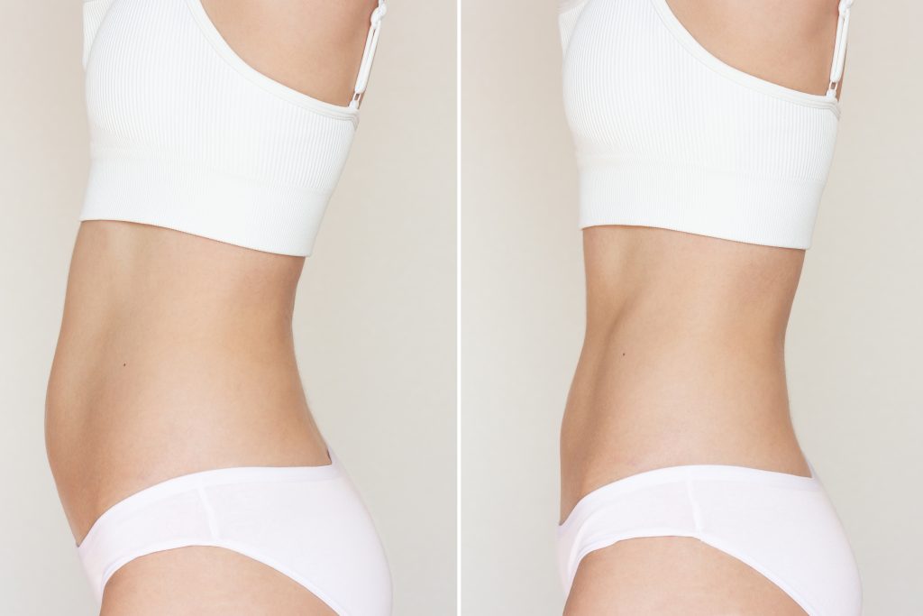 before after slim view woman showing waist abdomen